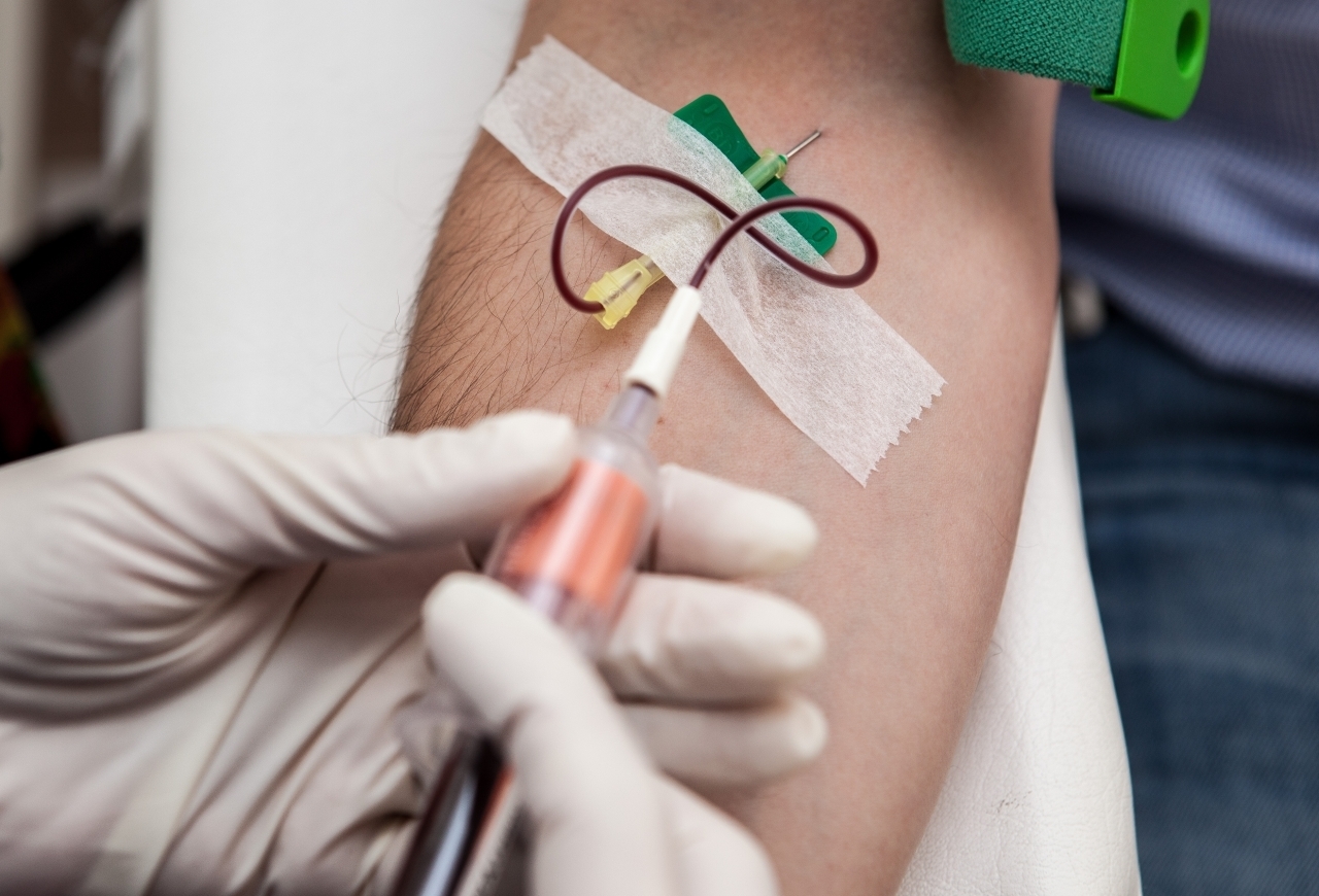 nuovi esami del sangue per la prostata nuovi esami del sangue per la prostata